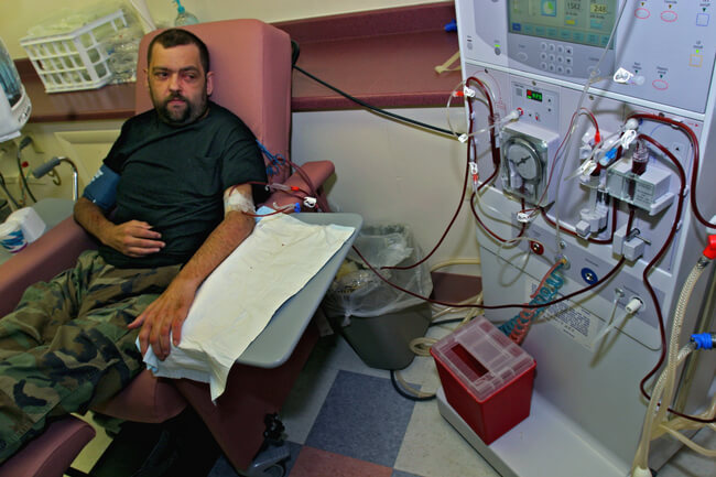 Dialysis patient. Whitesburg, KY, 2005.